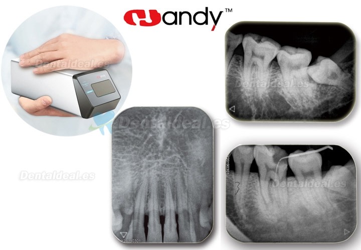 Handy HDS-500 PSP Scanner Dental Phosphor Plate Scanner